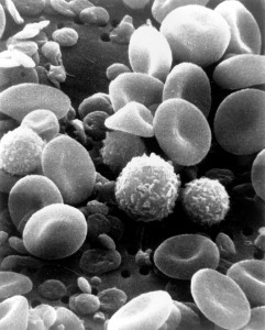A scanning electron microscope image of normal circulating human blood. In addition to the irregularly shaped leukocytes, both red blood cells and many small disc-shaped platelets are visible. Caption & credit: Wikimedia Commons
