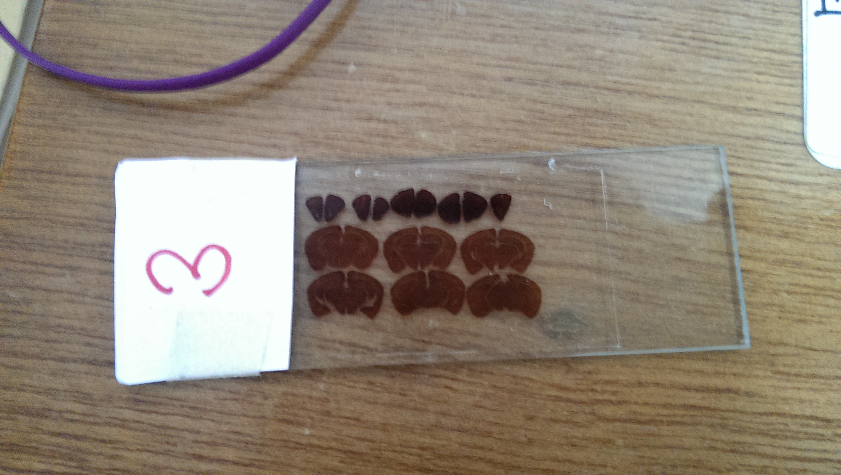 Slices of mouse brains in Vidita Vaidya's lab at TIFR. Credit: Nandita Jayaraj/TLoS