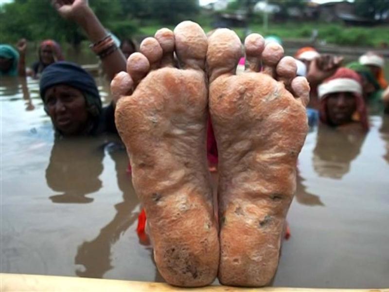 An NBA activist showing her feet during a previous jal satyagraha against the Sardar Sarovar Project. Credit: PTI/Files