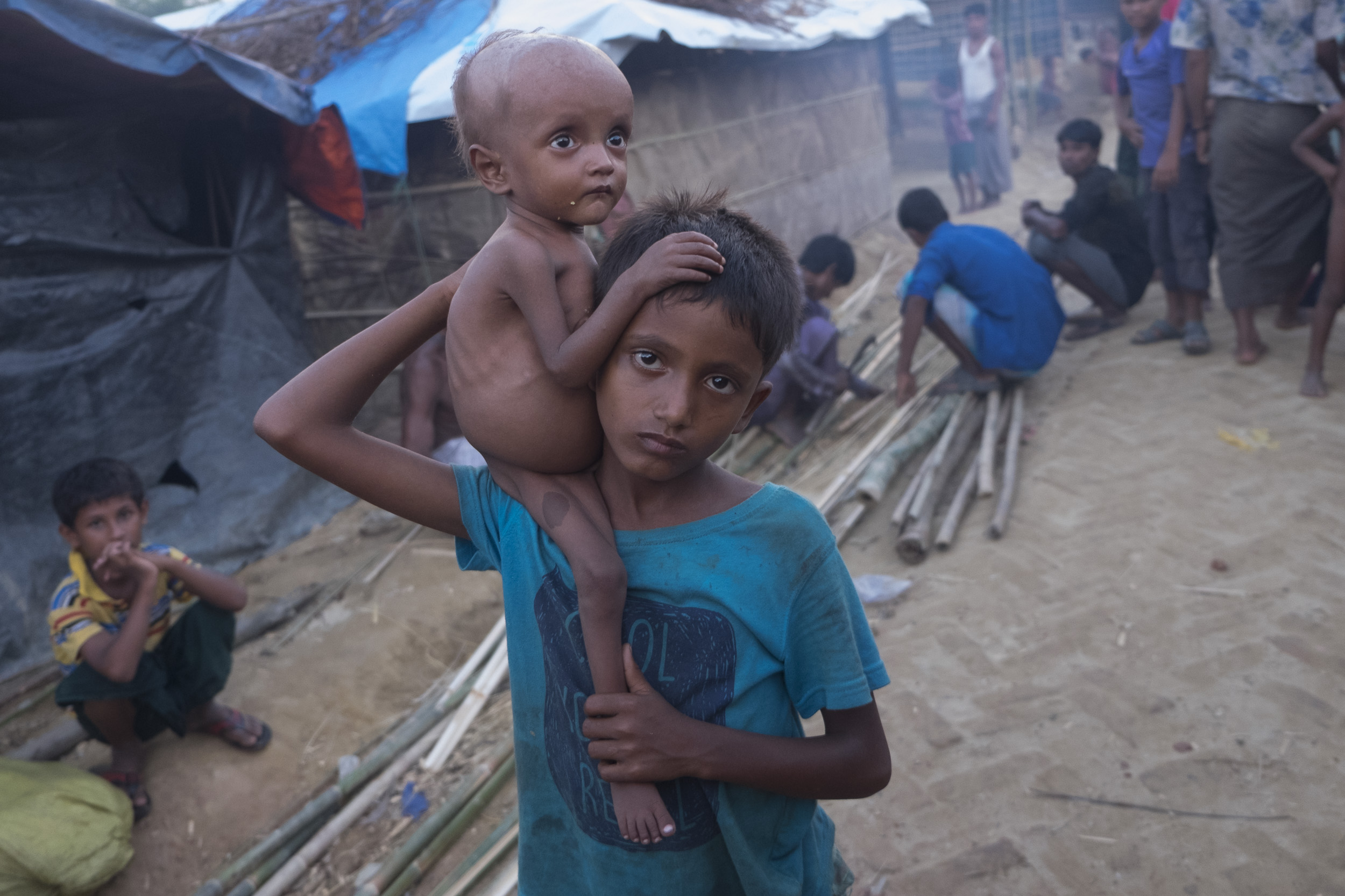 Malnourished children are a common sight inside the camp. Credit: Parvez Ahmed