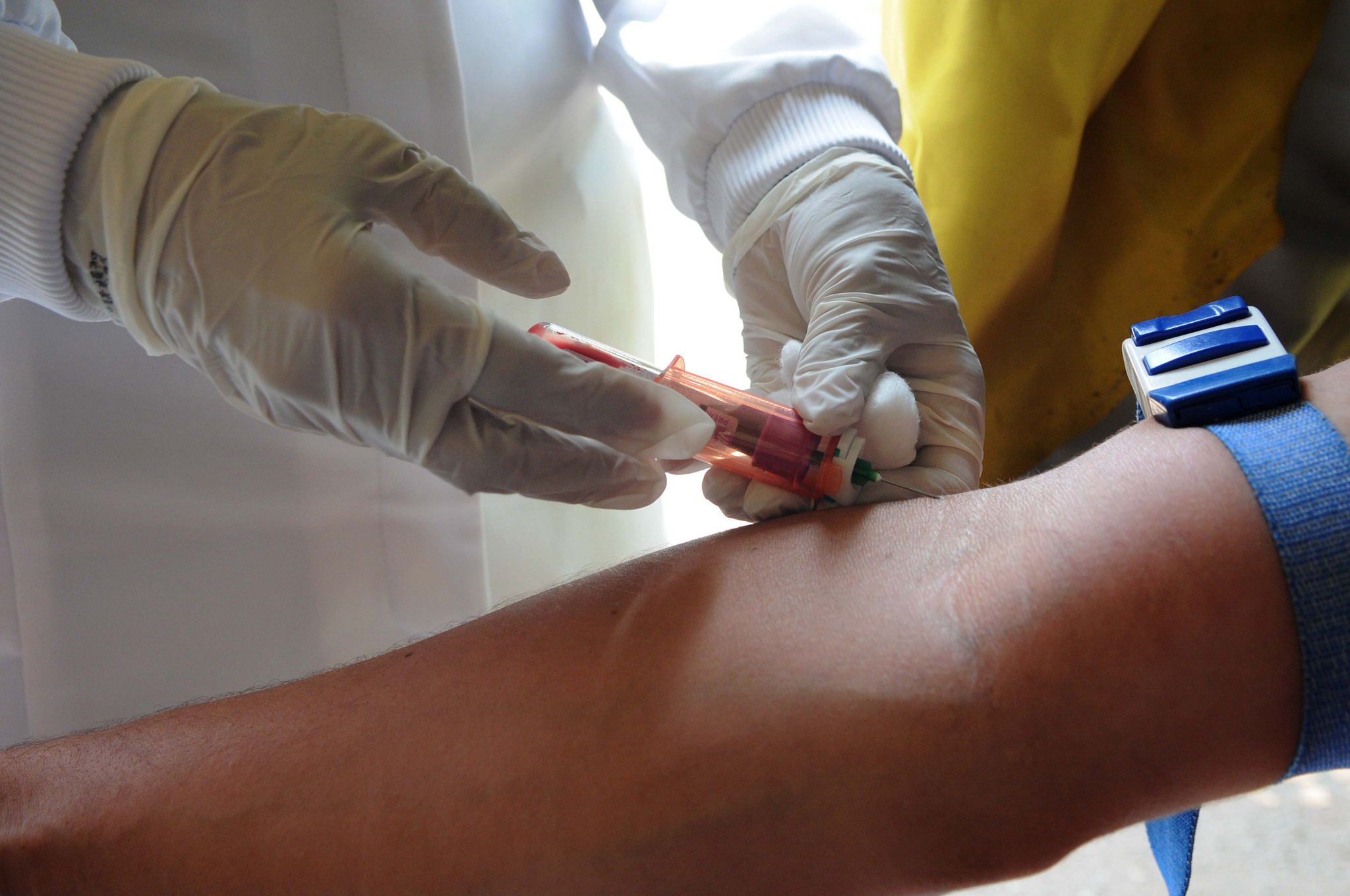 what it will take to make a zika vaccine