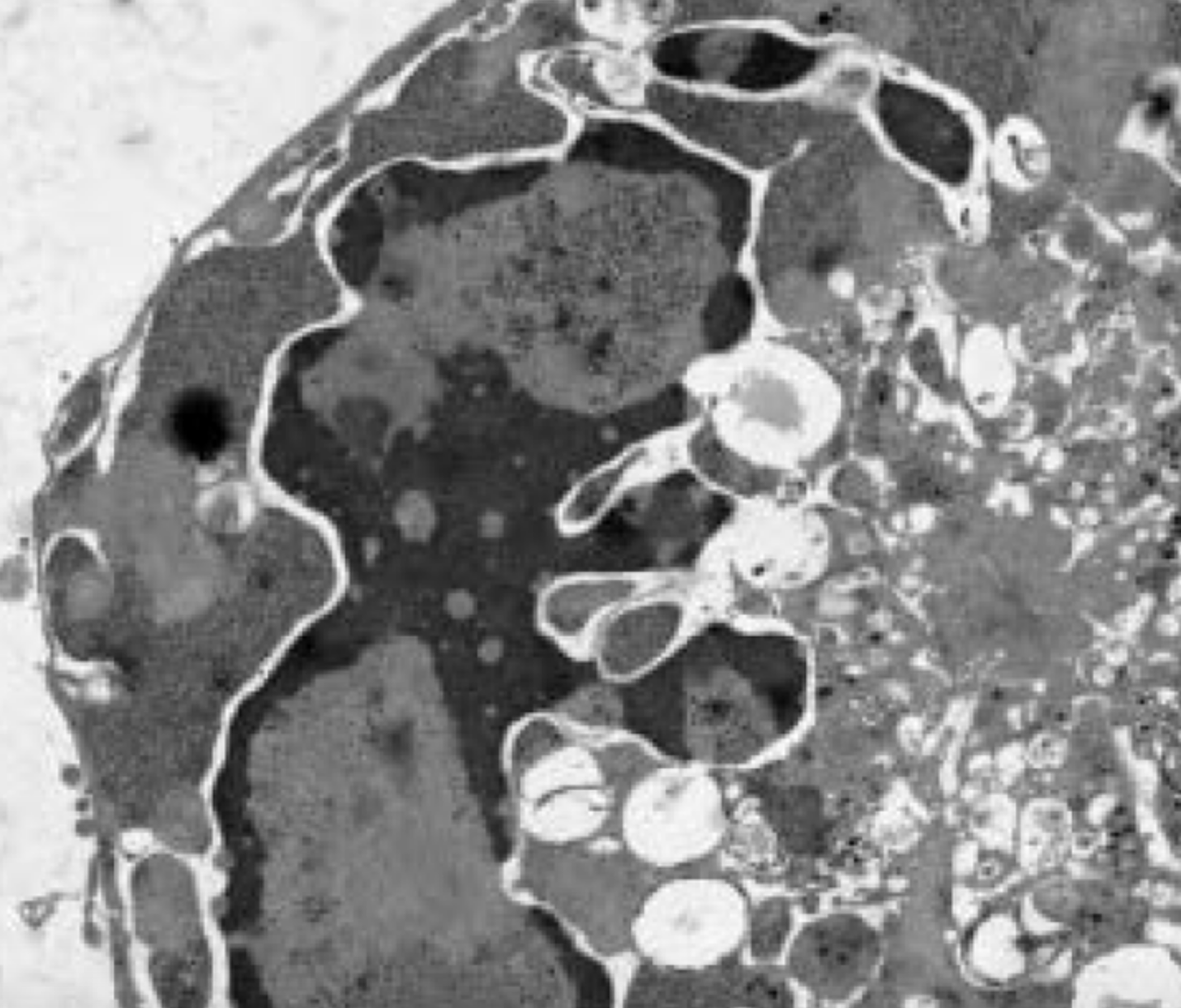 new temperature sensitive poliovirus strains show potential for use in  next gen  vaccines