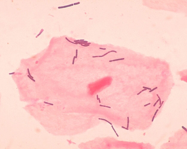 <em>Lactobacillus</em>. Credit: Wikimedia Commons