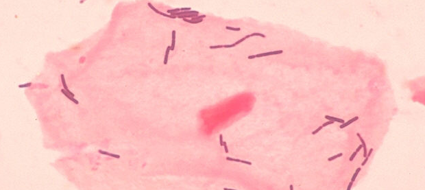 Lactobacillus. Credit: Wikimedia Commons