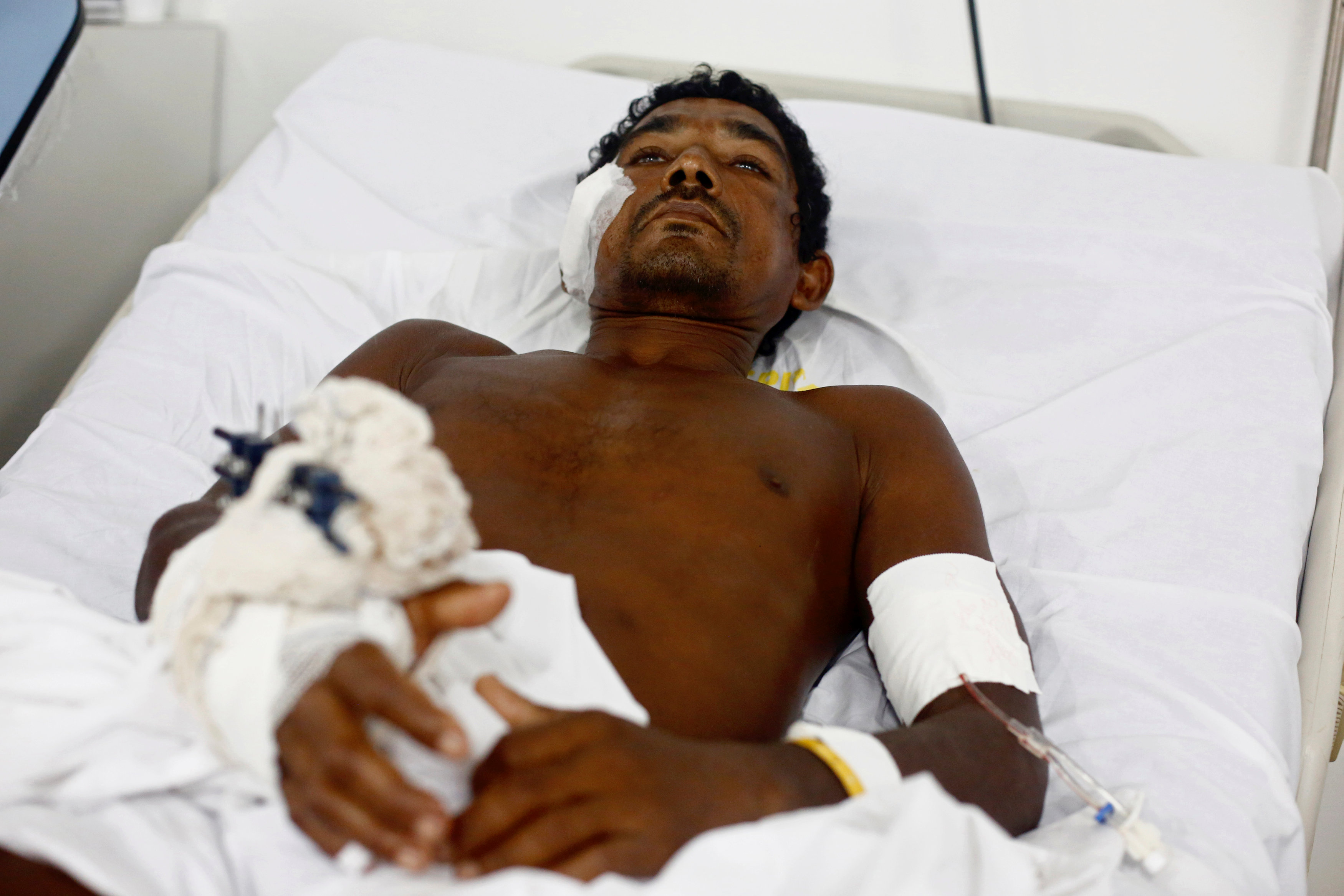 brazil state lowers death toll  says no hand severed in farmer tribe clash