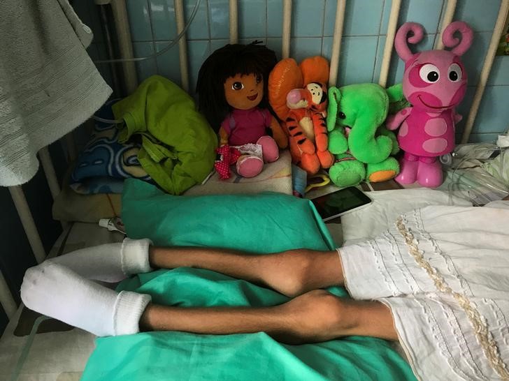 as crisis mounts in venezuela children die from preventable diseases  malnutrition