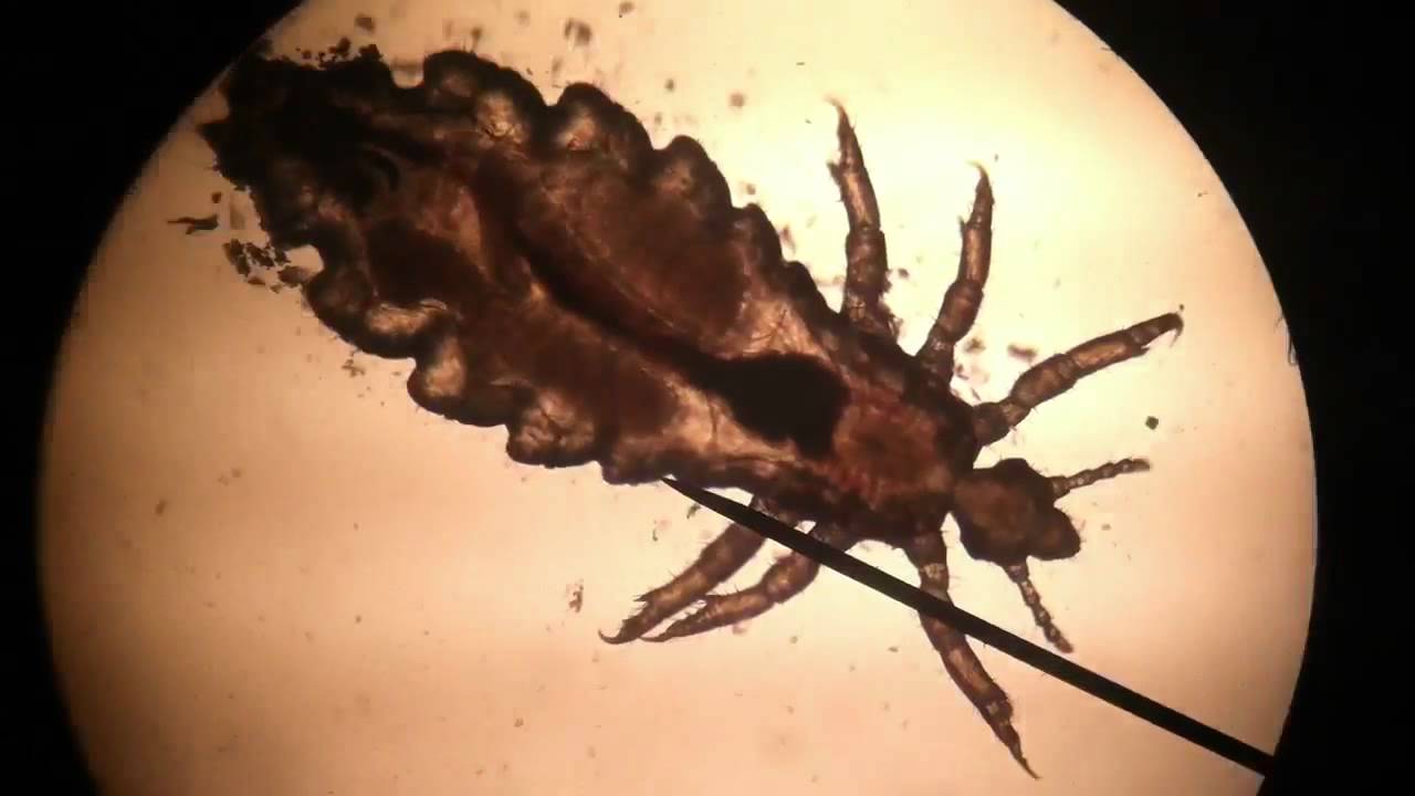 Lou's Insect How a Tiny Insect Was Used to Trace the Origins of Human Clothing - The ...