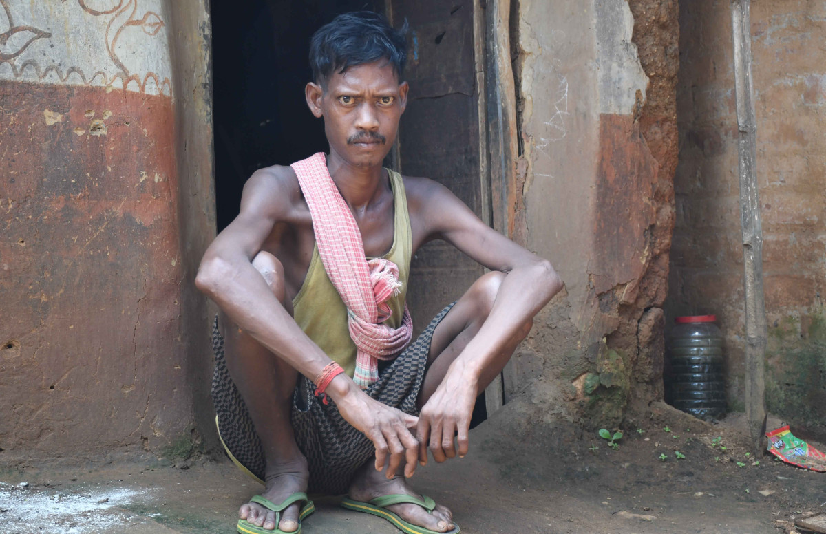 Gurupada Shabar, a resident of Darra village, is suffering from malnutrition.
