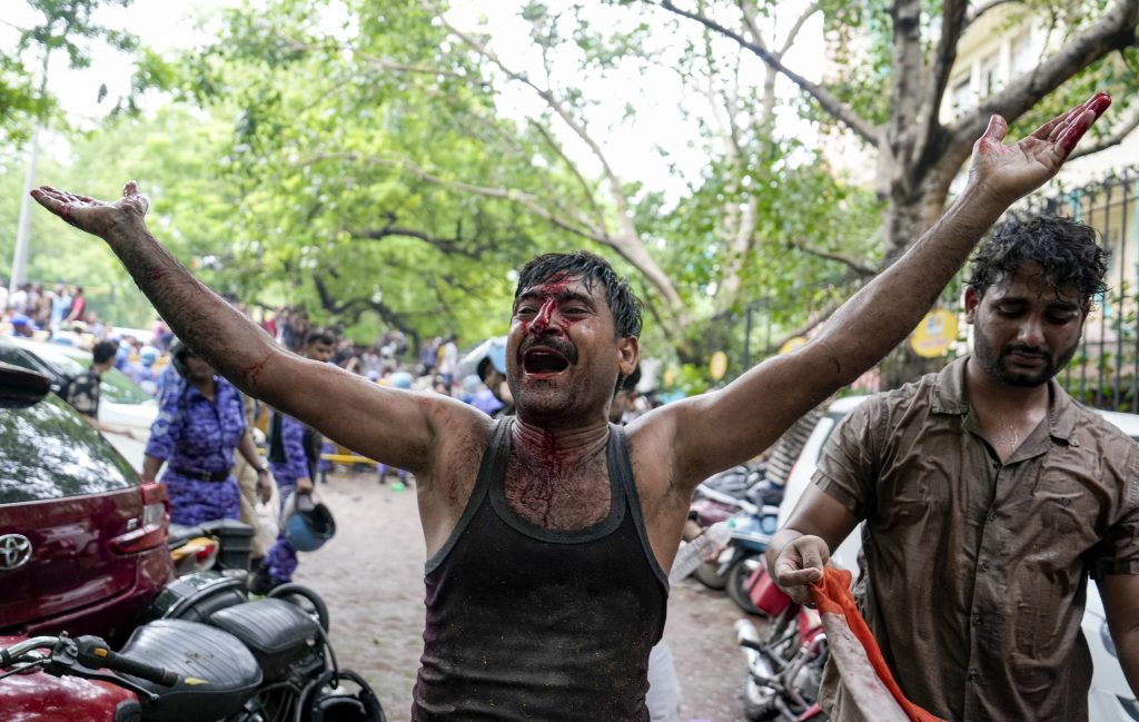 An image of a protestor injured in Jantar Mantar, New Delhi.